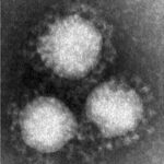 コロナウイルスの名前はSARS2 サーズ2と判明
