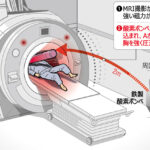 MRIが磁力で酸素ボンベを吸い込む…検査中の患者が挟まれ死亡  [135853815]