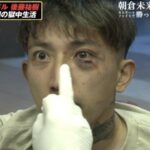 【画像】　朝倉未来に負けた後藤真希の弟さん　前歯を折られ左目が潰れる  [307982957]