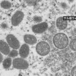 新型天然痘、最初の感染者は「ゲイとバイの男性グループ」、感染経路は「サルとの性行為」  [422186189]