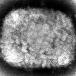 新型天然痘、皮膚接触や飛沫で感染  [422186189]