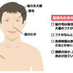 毎日風呂はいってないのにフケとかゆみがやばい。たすけよ！！  [163129606]